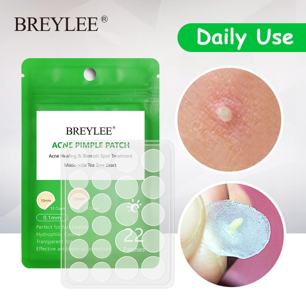 BREYLEE Acne Pimple Patch - Acne Treatment Stickers