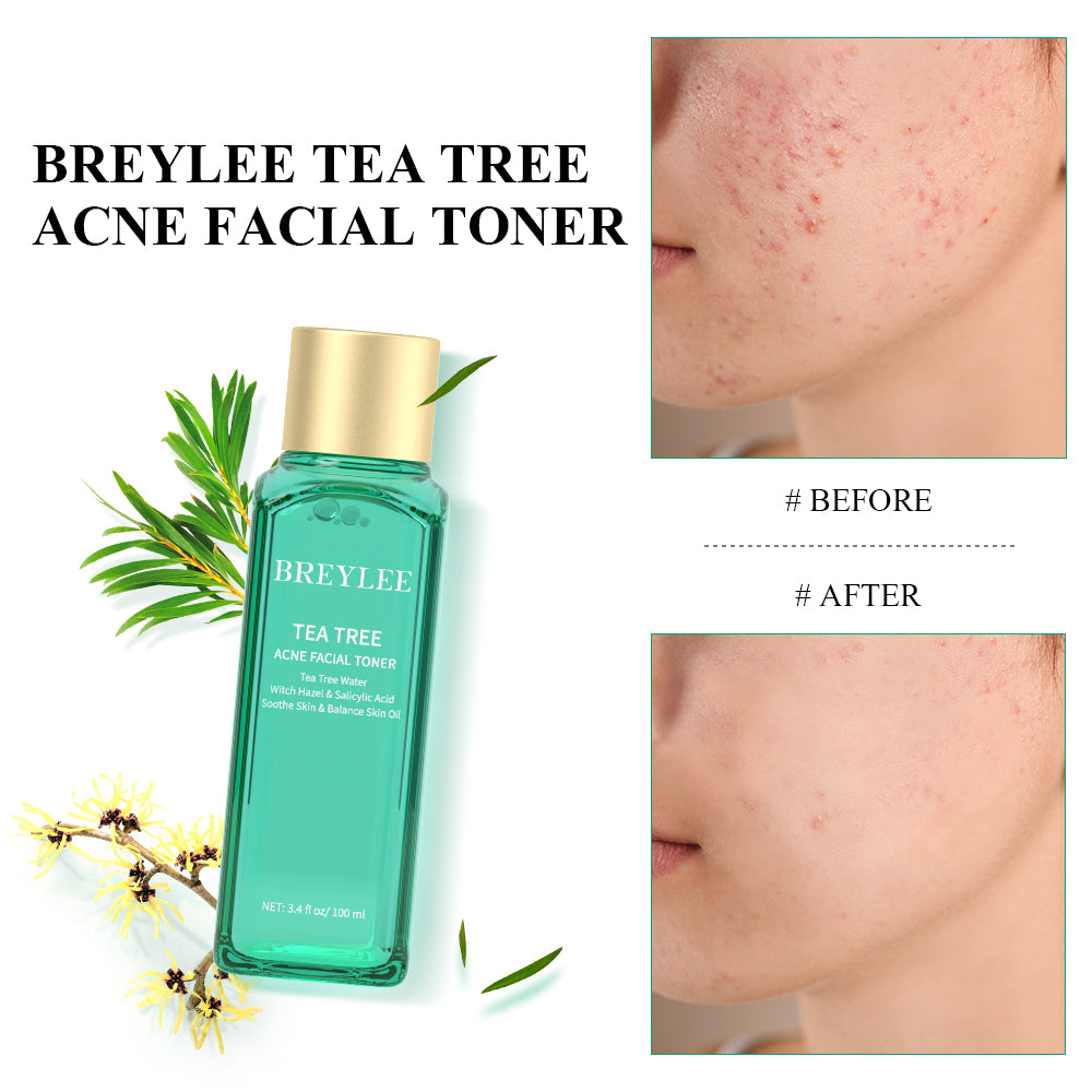 Tea Tree Acne Facial Toner