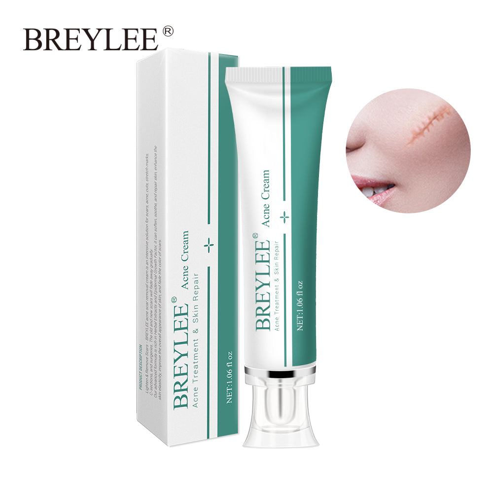 BREYLEE Acne Scar Removal Cream Treating Scars